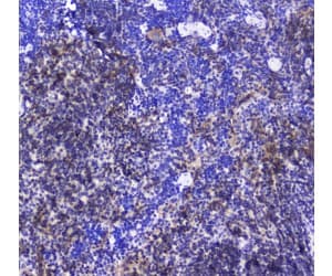 INPP5D / SHIP1 / SHIP Antibody