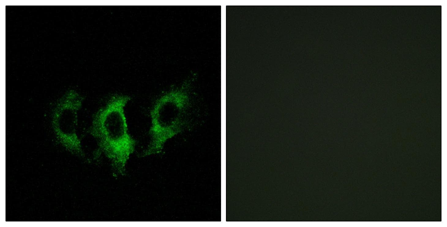 GFM2 Antibody