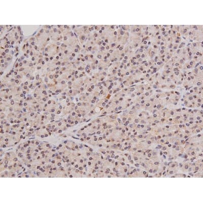 Polyclonal Rabbit anti-Human c-Kit / CD117 Antibody (IHC, IF, WB)