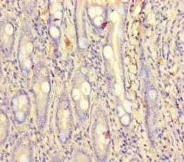 Polyclonal Rabbit anti-Human PCF11 Antibody (IHC)