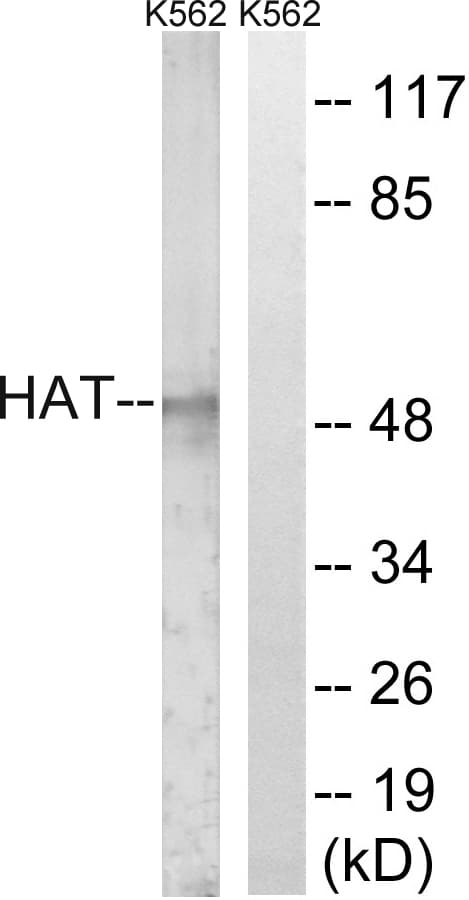 Polyclonal Rabbit anti-Human HAT1 Antibody (aa331-380, WB)
