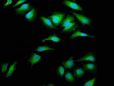AIMP1 / EMAP II Antibody