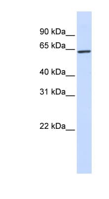 KLHL25 Antibody (aa144-193)