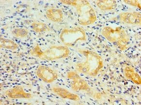 SRSF4 / SFRS4 Antibody (aa1-180)