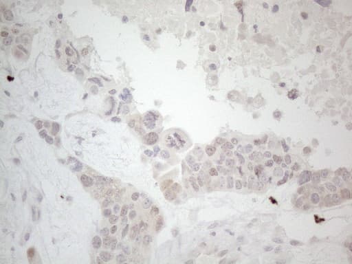Monoclonal Mouse anti-Human LPIN1 / Lipin 1 Antibody (clone OTI1B2, aa1-274, IHC, WB)