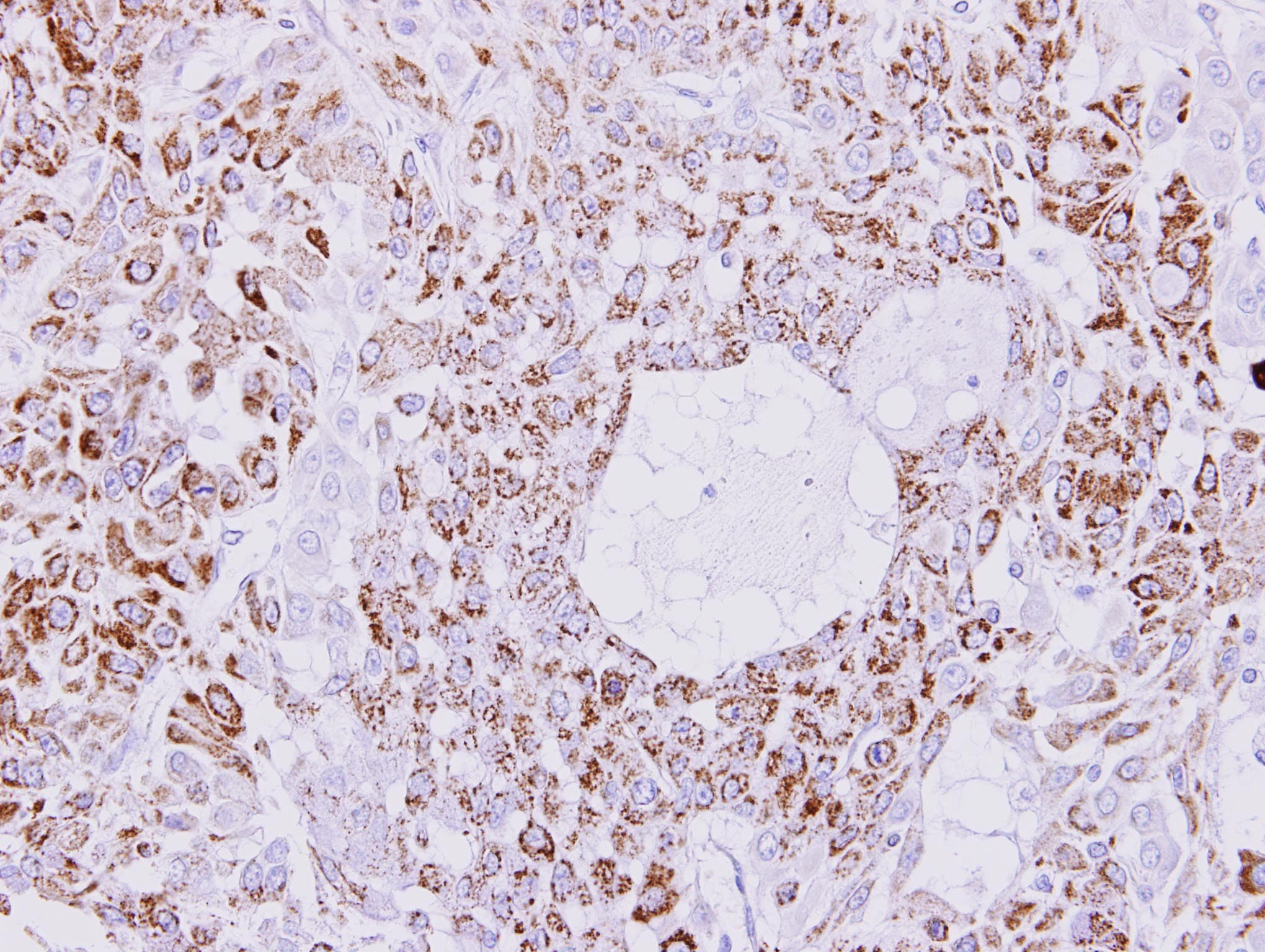 IHC-plus™ CKMT1B Antibody (aa63-287)
