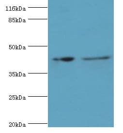 RNF133 Antibody (Biotin)