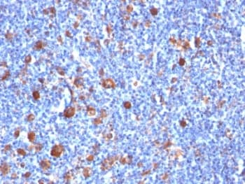 FSCN1 / Fascin Antibody (clone SPM133, Azide-free, BSA-free)