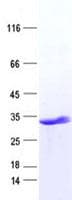 Human DLX1 Protein (Recombinant His, N-Terminal)