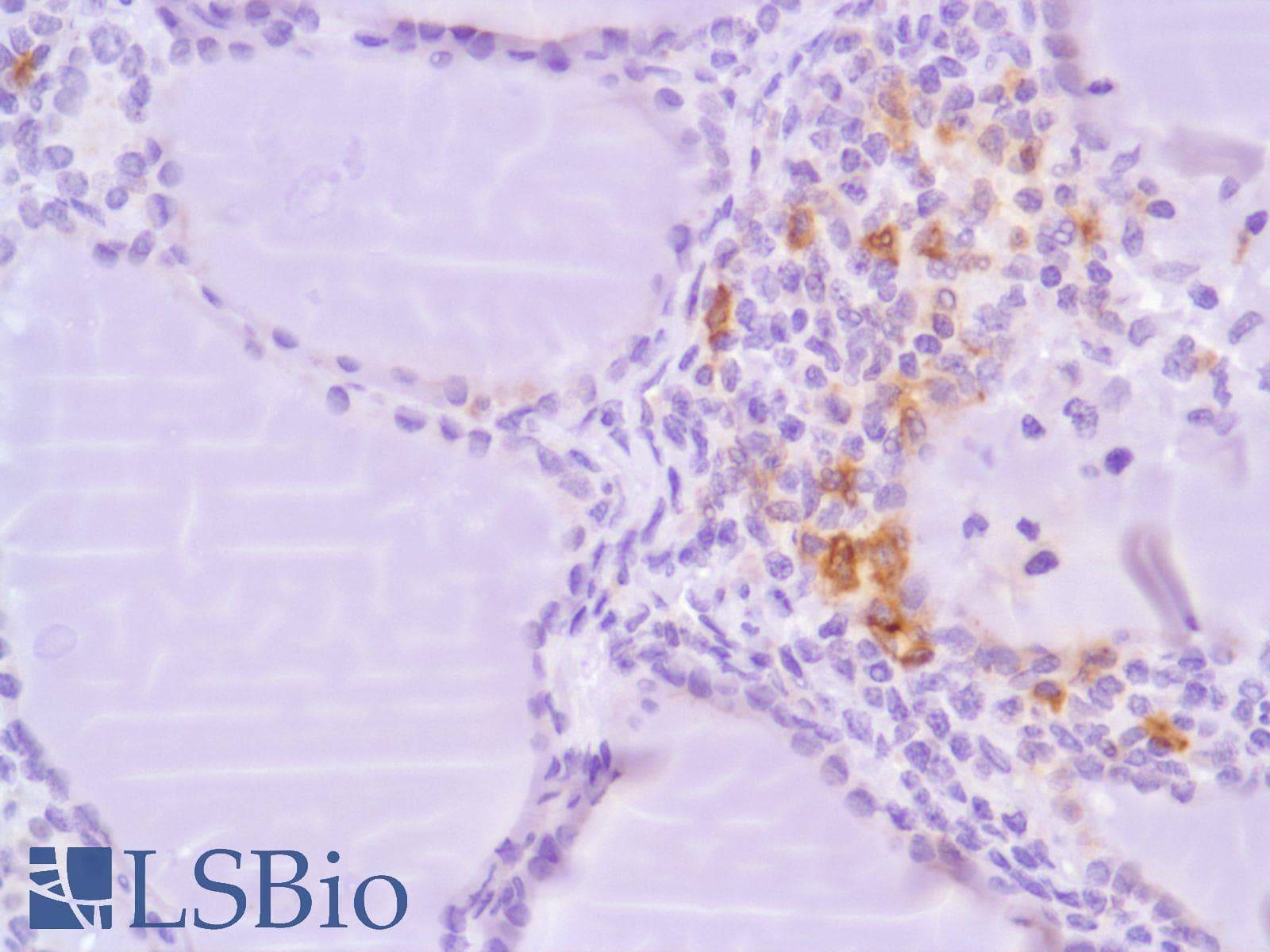 ICOS / CD278 Antibody (C-Terminus, clone SP98)