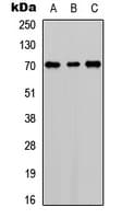 Polyclonal Rabbit anti-Human F11 / FXI / Factor XI Antibody (Internal, WB)