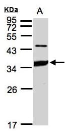 ICAM2 / CD102 Antibody (aa1-189)