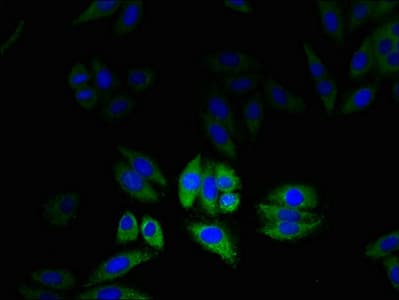 Polyclonal Rabbit anti-Human CLIC2 Antibody