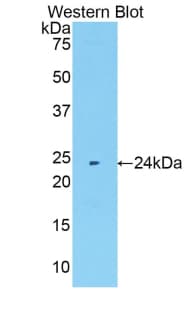 MMP11 Antibody (aa302-458, FITC)