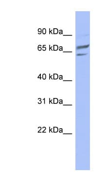 Polyclonal Rabbit anti-Human PGM1 / Phosphoglucomutase 1 Antibody (C-Terminus, WB)