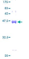 Human RBBP9 Protein (Recombinant GST)
