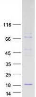 Human EDDM3B Protein (Recombinant Myc-DDK (Flag))