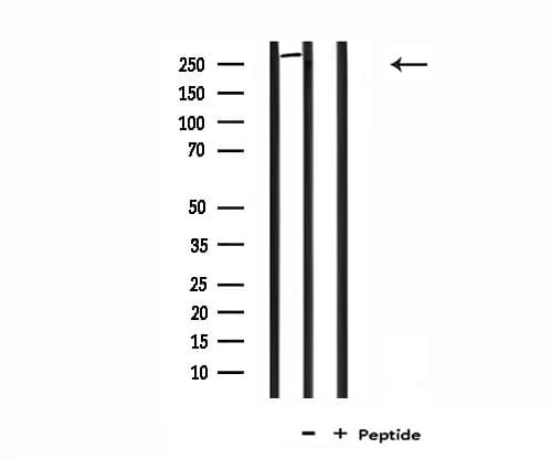 F8 / FVIII / Factor VIII Antibody (aa2187-2209)