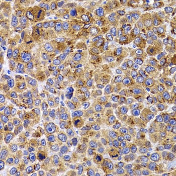 UBE2R2 Antibody