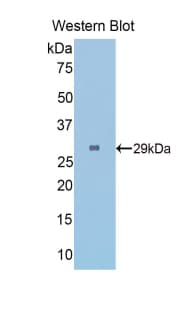 FGG / Fibrinogen Gamma Antibody (aa168-405, PE)