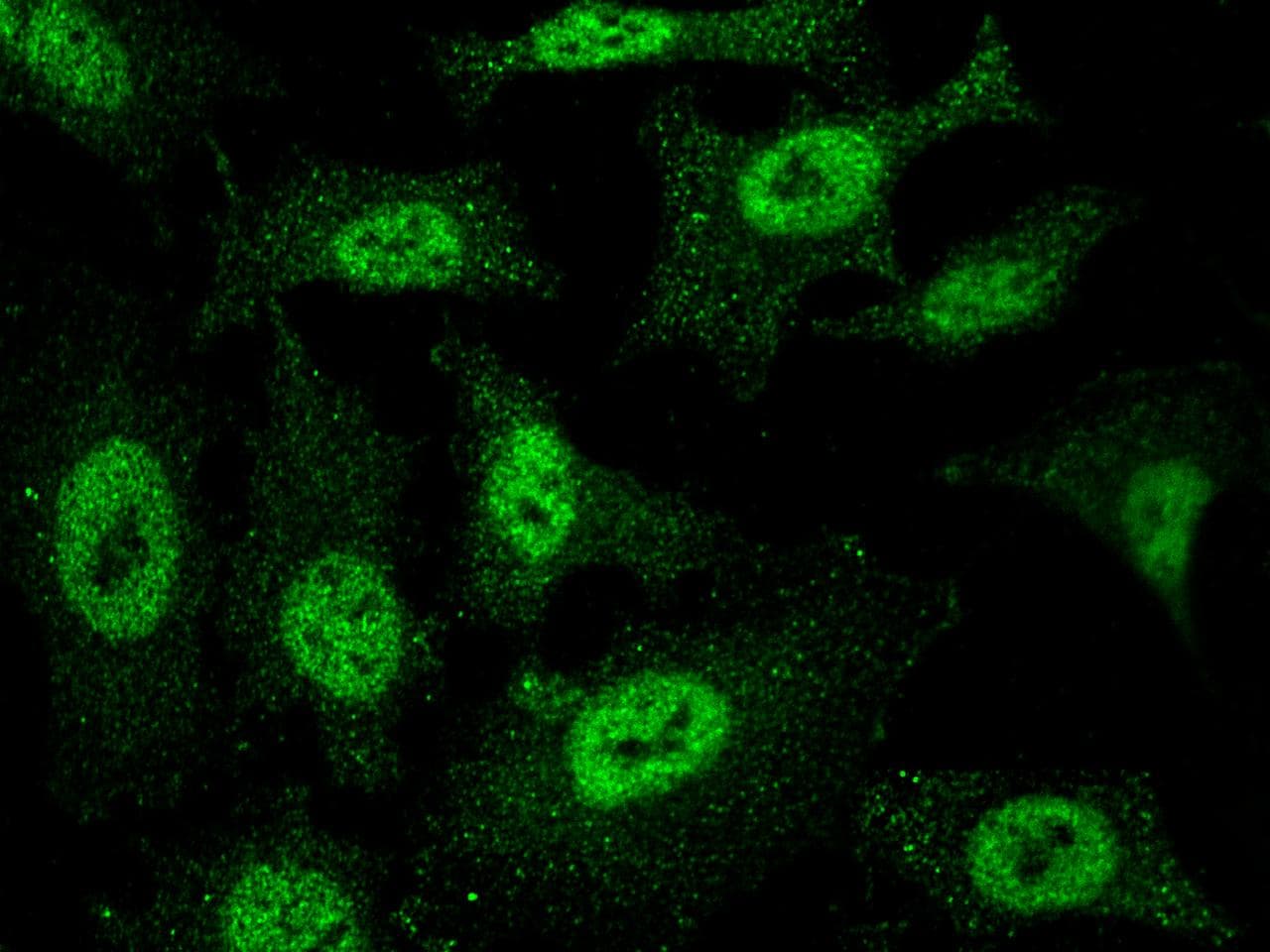 Monoclonal Mouse anti-Human ESR2 / ER Beta Antibody (clone 09, Preservative Free, IF)
