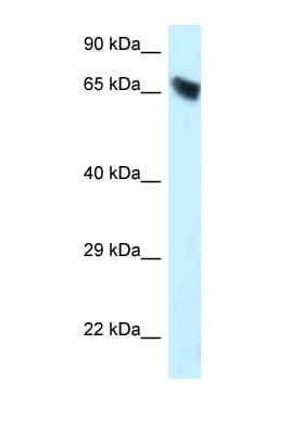 Carboxylesterase 3 / CES3 Antibody (C-Terminus)