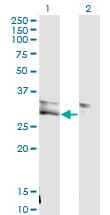 VWF / Von Willebrand Factor Antibody (clone 1A11)