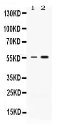 MEF2A / MEF2 Antibody