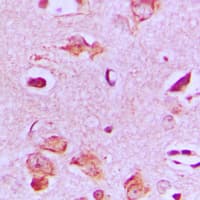 Polyclonal Rabbit anti-Human MAST4 Antibody (N-Terminus, IHC, IF, WB)