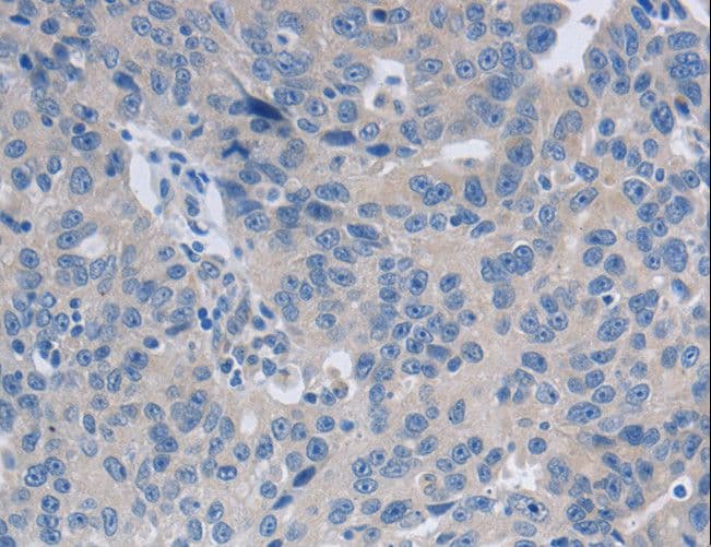 Polyclonal Rabbit anti-Human GRIN1 / NMDAR1 Antibody (IHC)