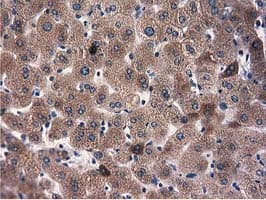 Monoclonal Mouse anti-Human L1CAM Antibody (clone OTI2H6, IHC, IF, WB)