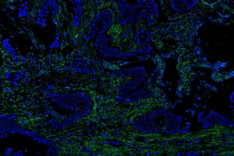 Polyclonal Rabbit anti-Human ANXA6/Annexin A6/Annexin VI Antibody (IHC, WB)
