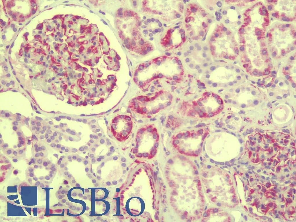 IHC-plus™ SLAIN1 Antibody