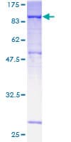 Human DMPK / DM Protein (Recombinant GST)