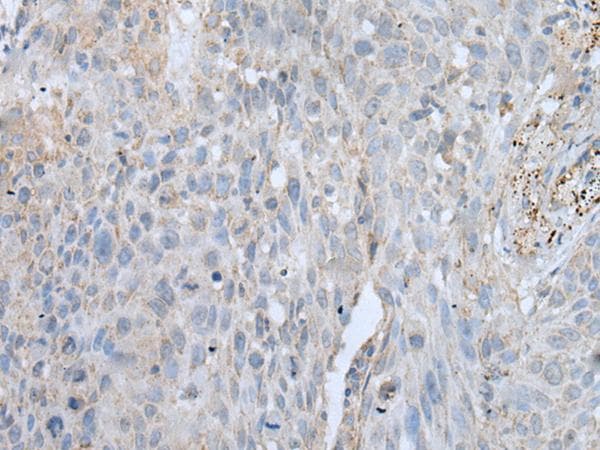 VWA2 Antibody