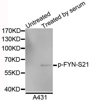 SYN / FYN Antibody (phospho-Ser21)