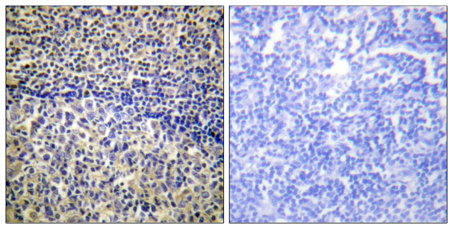 NCF1 / p47phox / p47 phox Antibody (aa301-350)