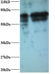 Polyclonal Rabbit anti-Human IMPDH2 Antibody (HRP, IHC, WB)