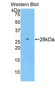 ADAM15 Antibody (aa211-451)