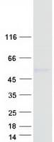 Human AMN Protein (Recombinant Myc-DDK (Flag))