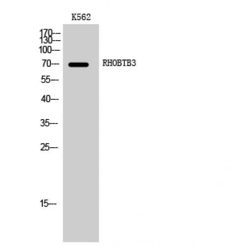 RHOBTB3 Antibody (310-390 aa, Internal)