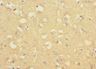 Polyclonal Rabbit anti-Human LRRC4C Antibody (IHC)