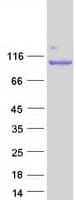 Human NCL / Nucleolin Protein (Recombinant Myc-DDK (Flag))