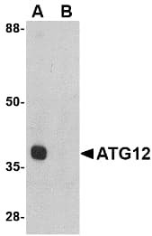 IHC-plus™ APG12 / ATG12 Antibody