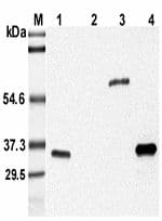 Adiponectin Antibody (clone MADI 04)