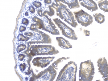PRKCB / PKC-Beta Antibody