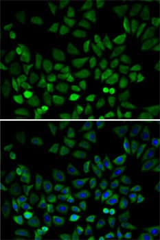 Polyclonal Rabbit anti-Human CDK4 Antibody (IHC, IF, WB)