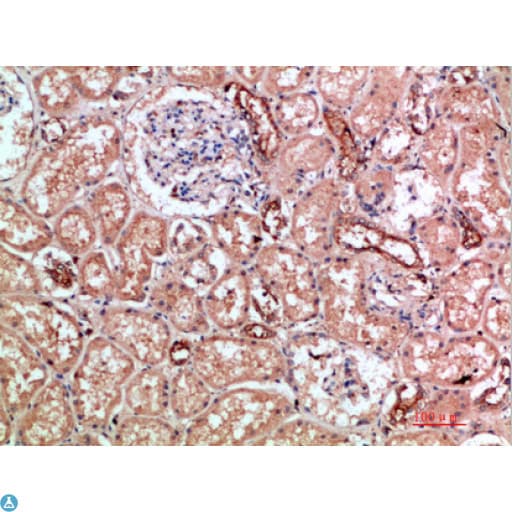 Polyclonal Rabbit anti-Human ITGAM / CD11b Antibody (IHC)
