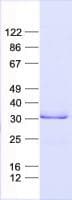 Human CTDSPL Protein (Recombinant His, N-Terminal)