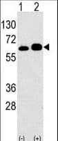 RPS6KB1 / P70S6K / S6K Antibody (aa277-306)